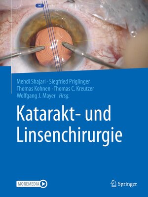 cover image of Katarakt- und Linsenchirurgie